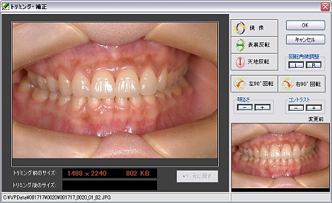 ���ȃC���t�H�[���h�R���Z���g�p�f�W�^���摜�Ǘ��\�t�g VP�V�X�e���@��ʂ̃g���~���O�A�C�����