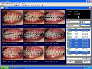 歯科インフォームドコンセント用デジタル画像管理ソフト VPシステム 部位指定経時列表示画面