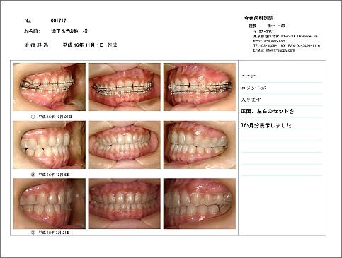 ���ȃC���t�H�[���h�R���Z���g�p�f�W�^���摜�Ǘ��\�t�g ����������Ȉ㎡�Ìv��������Q