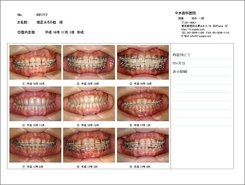���ȃC���t�H�[���h�R���Z���g�p�f�W�^���摜�Ǘ��\�t�g ����������Ȉ㎡�Ìv��������R